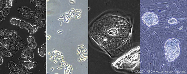 蔡司Primovert 徠卡DMiL Olympus CKX53 舜宇ICX41 Motic AE2000倒置相差顯微鏡細胞圖像中的偽影.jpg